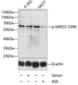 Western blot analysis of extracts of K-562 and MCF-7 cells, using Anti-MEF2C (phospho Ser396) Antibody (A10882) at 1:1,000 dilution. K562 cells were treated by 10% FBS for 30 minutes after serum-starvation overnight.