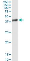 Anti-HAO2 Polyclonal Antibody Pair