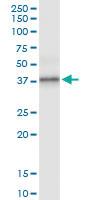 Anti-PPP1R3C Polyclonal Antibody Pair