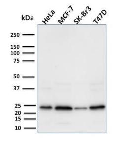 Anti-Mammaglobin A antibody