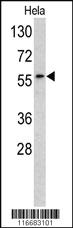 Anti-RYK Rabbit Polyclonal Antibody