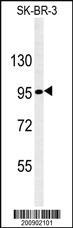 Anti-NPHS1 Mouse Monoclonal Antibody