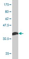 Anti-CYP46A1 Mouse Monoclonal Antibody [clone: 1A11]