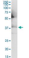 Anti-IL1A Antibody Pair