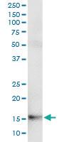 Anti-FABP7 Polyclonal Antibody Pair