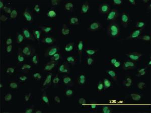 Anti-SNAI2 Mouse Monoclonal Antibody [clone: 2F11]