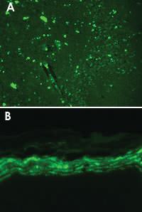 Anti-SCN9A Mouse Monoclonal Antibody [clone: S68-6]