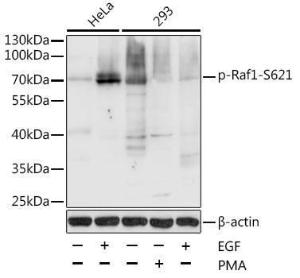 Anti-Raf1 Rabbit Polyclonal Antibody