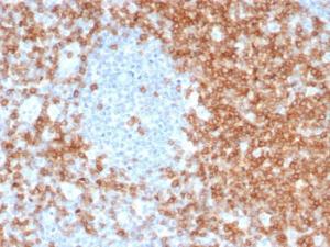 Immunohistochemical analysis of formalin-fixed, paraffin-embedded human tonsil tissue using Anti-CD5 Antibody [C5/6463R]