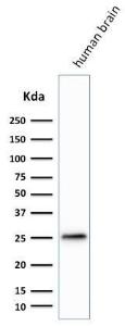 Western blot analysis of human brain lysate using Anti-PGP9.5 Antibody [SPM574]