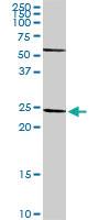 Anti-HLA-DRA Rabbit Polyclonal Antibody