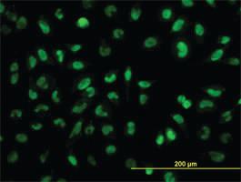 Anti-SNAI2 Mouse Monoclonal Antibody [clone: 2F11]