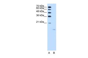 Anti-ACP1 Rabbit Polyclonal Antibody