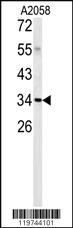 Anti-C1QTNF1 Rabbit Polyclonal Antibody