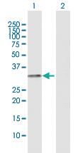 Anti-HLA-DRA Rabbit Polyclonal Antibody