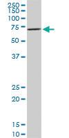 Anti-RPS6KB1 Mouse Monoclonal Antibody [clone: 2C2]