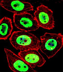 Anti-EWSR1 Rabbit polyclonal antibody