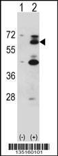 Anti-YES1 Rabbit Polyclonal Antibody