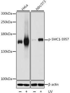 Anti-SMC1A