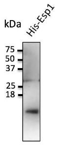 Anti-ESP1 Antibody at a 1:1000 dilution, 20ng of recombinant protein, and rabbit anti-goat IgG antibody (HRP) at a 1:10000 dilution