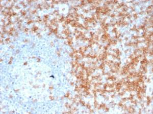 Immunohistochemical analysis of formalin-fixed, paraffin-embedded human tonsil tissue using Anti-CD5 Antibody [C5/6463R]