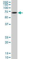 Anti-RPS6KB1 Mouse Monoclonal Antibody [clone: 2C2]