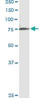 Anti-CUX1 Polyclonal Antibody Pair