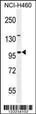 Anti-ITIH5 Rabbit Polyclonal Antibody