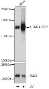 Anti-SMC1A