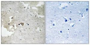 Immunohistochemical analysis of paraffin-embedded human brain using Anti-AXL (phospho Tyr691) Antibody. The right hand panel represents a negative control, where the antibody was pre-incubated with the immunising peptide