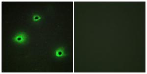 Immunofluorescence analysis of A549 cells using Anti-GRAH Antibody The right hand panel represents a negative control, where the antibody was pre-incubated with the immunising peptide