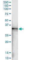 Anti-HLA-DRA Rabbit Polyclonal Antibody