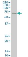 Anti-RPS6KB1 Mouse Monoclonal Antibody [clone: 2C2]