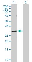 Anti-NUDT5 Rabbit Polyclonal Antibody