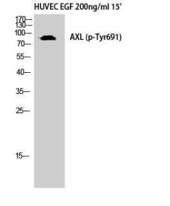 Western blot analysis of HuvEc cells using Anti-AXL (phospho Tyr691) Antibody