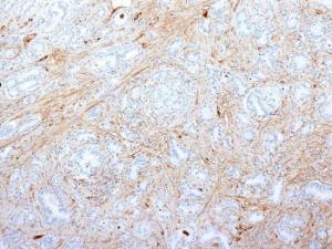 Antibody anti-fibronectin SPM539 100 µg