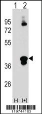 Anti-C1QTNF1 Rabbit Polyclonal Antibody