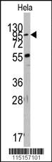 Anti-PDIA5 Rabbit Polyclonal Antibody