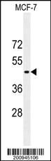 Anti-GFAP Mouse Monoclonal Antibody