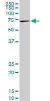 Anti-RPS6KB1 Mouse Monoclonal Antibody [clone: 2C2]