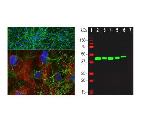 Left: Analysis of cortical neuron-glial cell cµlture from E20 with rabbit antibody to GAP43 (green) and mouse antibody to vimentin (red) by ICC. Blue: DAPI nuclear stain. Right: Western blot analysis of tissue and cell lysates using rabbit antibody to GAP43.