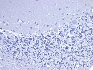 Negative Tissue Control: Immunohistochemical analysis of formalin-fixed, paraffin-embedded human brain using Anti-CD5 Antibody [C5/6463R] at 2 µg/ml in PBS for 30 minutes at room temperature