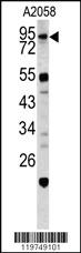 Anti-CALD1 Rabbit Polyclonal Antibody