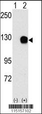 Anti-TYRO3 Rabbit Polyclonal Antibody