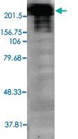 Anti-SCN9A Mouse Monoclonal Antibody [clone: S68-6]