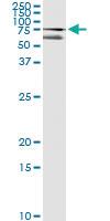 Anti-CUX1 Antibody Pair