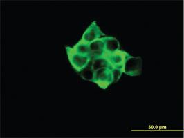 Anti-RPS6KB1 Mouse Monoclonal Antibody [clone: 2C2]