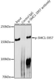 Anti-SMC1A