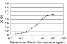 Anti-RPS6KB1 Mouse Monoclonal Antibody [clone: 2C2]