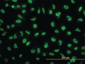 Anti-SNAI2 Mouse Monoclonal Antibody [clone: 4D11]